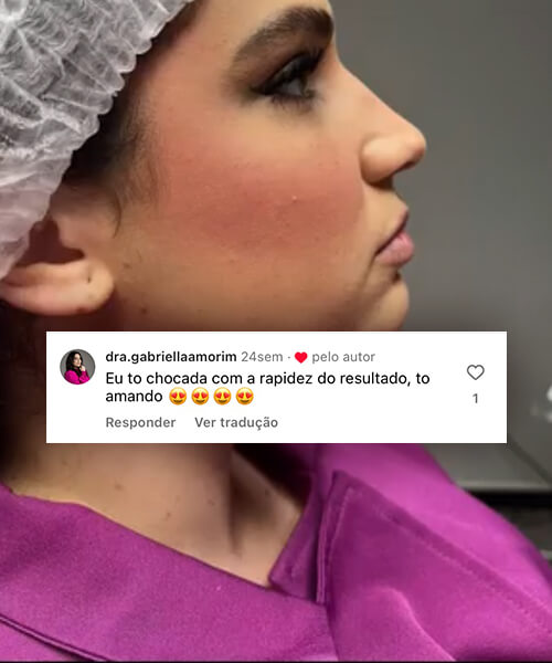 Dra Renata Brescovici Procedimentos Estéticos Dermatologista em Porto Velho Toxina Botulínica Harmonização Facial Preenchimento de Olheiras Preenchimento Labial Blefaroplastia Liftera Bioestimuladores de Colágeno Peelings Químicos Fios de PDO Skinbooster